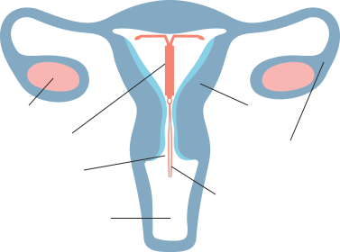 How Does LILETTA® IUS (also known as IUD) Work? Official Site